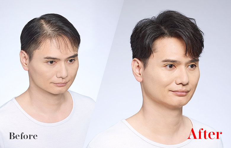 活用自髮來增加髮量，不必額外費心打理。