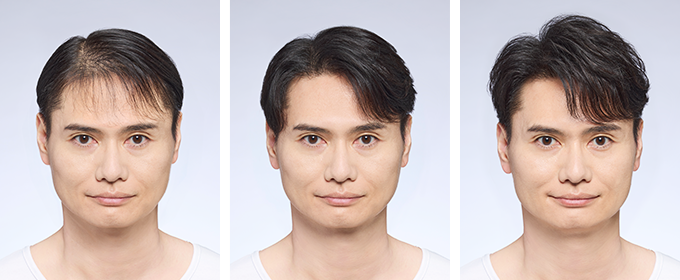 Before & After