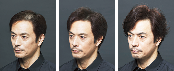Before & After