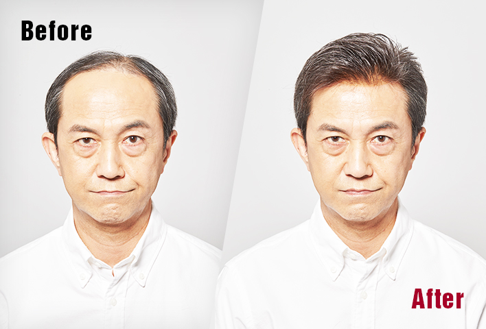 局部或全體髮量提升,都能根據您要求調整