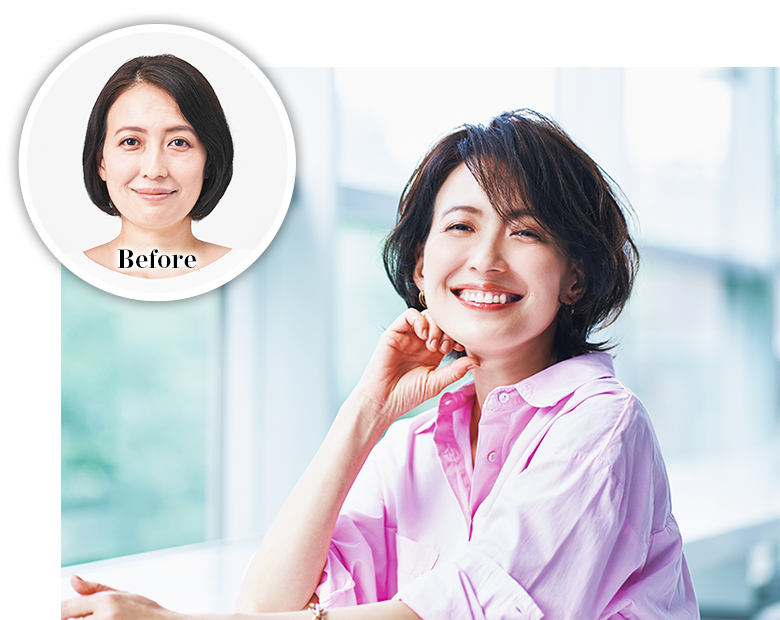 Aderans 訂造假髮